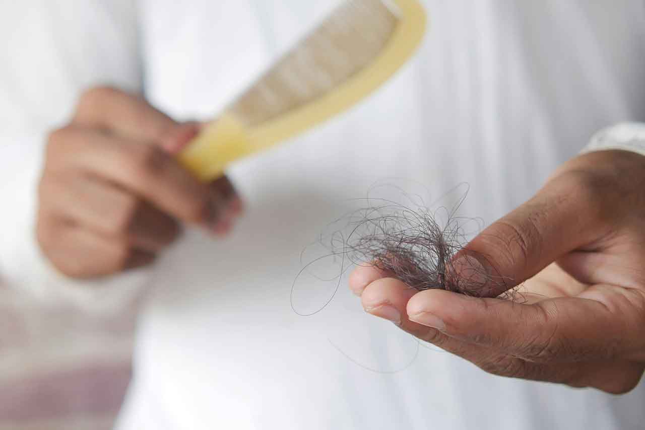 Rambut Rontok? Treatment Apa yang Cocok? Panduan Lengkap Mengatasi Kerontokan Rambut