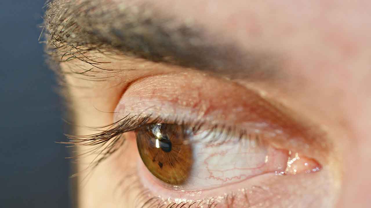 Berapa Lama Seharusnya Eyelash Extension Bertahan
